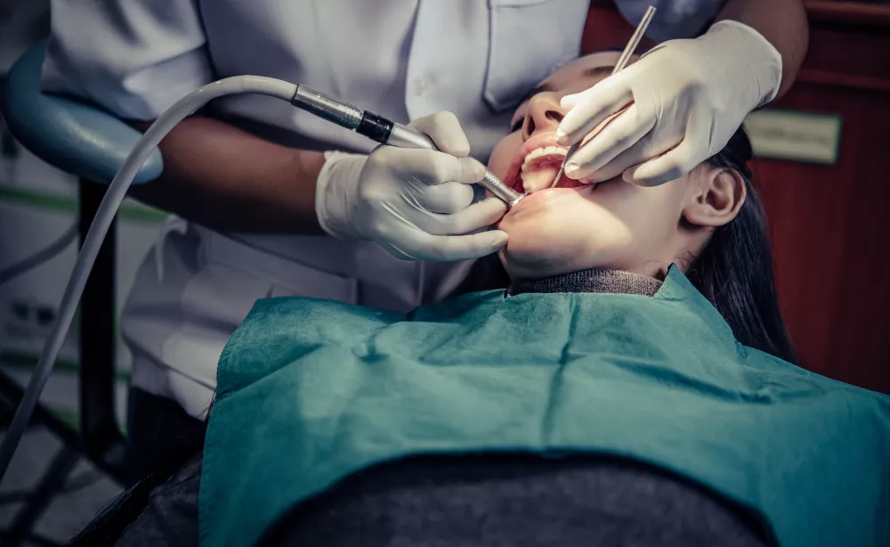 Tooth Fillings